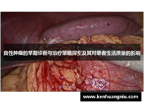 良性肿瘤的早期诊断与治疗策略探索及其对患者生活质量的影响